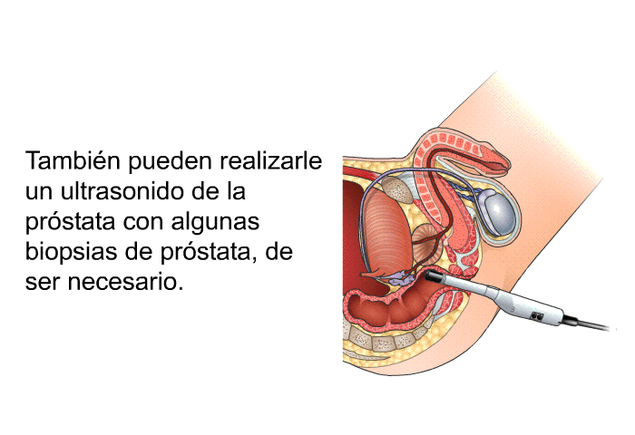 Tambi�n pueden realizarle un ultrasonido de la pr�stata con algunas biopsias de pr�stata, de ser necesario.