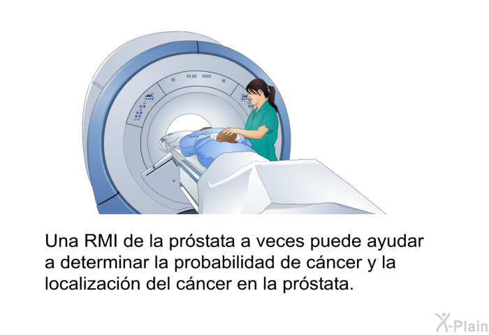 Una RMI de la pr�stata a veces puede ayudar a determinar la probabilidad de c�ncer y la localizaci�n del c�ncer en la pr�stata.