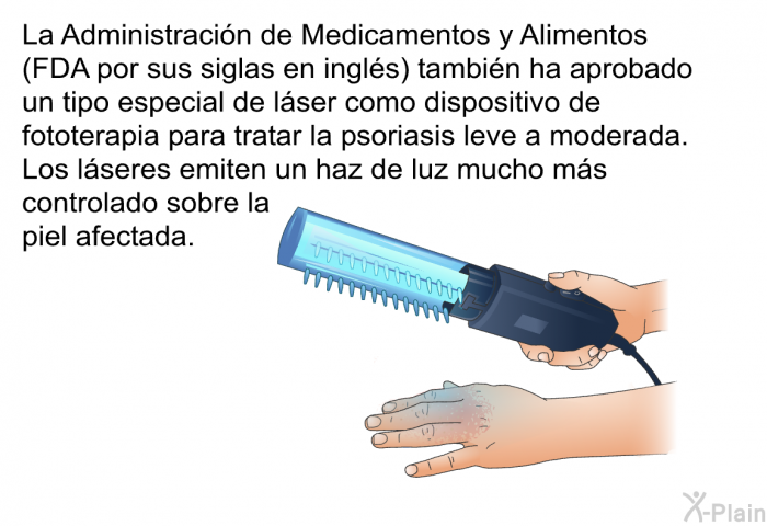 La Administraci�n de Medicamentos y Alimentos (FDA por sus siglas en ingl�s) tambi�n ha aprobado un tipo especial de l�ser como dispositivo de fototerapia para tratar la psoriasis leve a moderada. Los l�seres emiten un haz de luz mucho m�s controlado sobre la piel afectada.