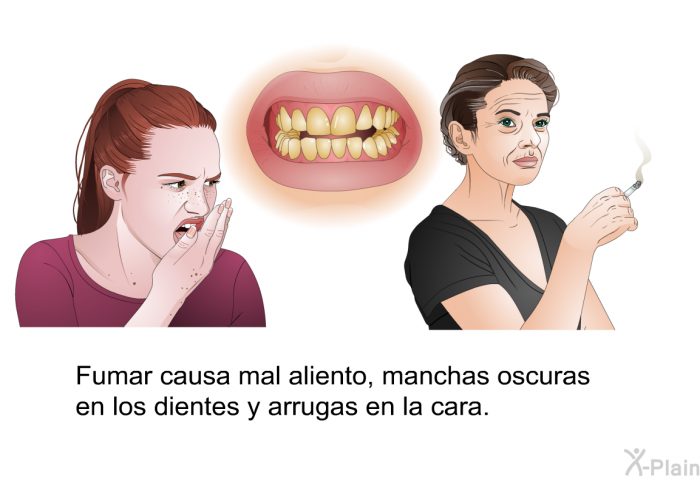 Fumar causa mal aliento, manchas oscuras en los dientes y arrugas en la cara.