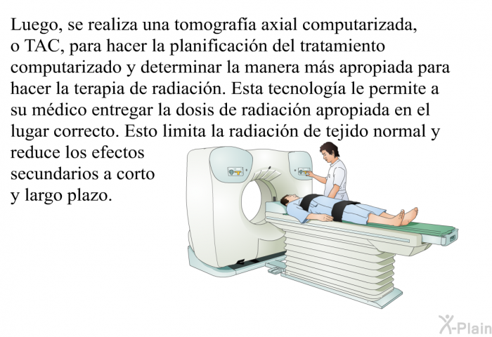 Luego, se realiza una tomografa axial computarizada, o TAC, para hacer la planificacin del tratamiento computarizado y determinar la manera ms apropiada para hacer la terapia de radiacin. Esta tecnologa le permite a su mdico entregar la dosis de radiacin apropiada en el lugar correcto. Esto limita la radiacin de tejido normal y reduce los efectos secundarios a corto y largo plazo.