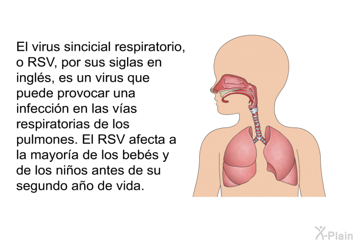El virus sincicial respiratorio, o RSV, por sus siglas en ingls, es un virus que puede provocar una infeccin en las vas respiratorias de los pulmones. El RSV afecta a la mayora de los bebs y de los nios antes de su segundo ao de vida.