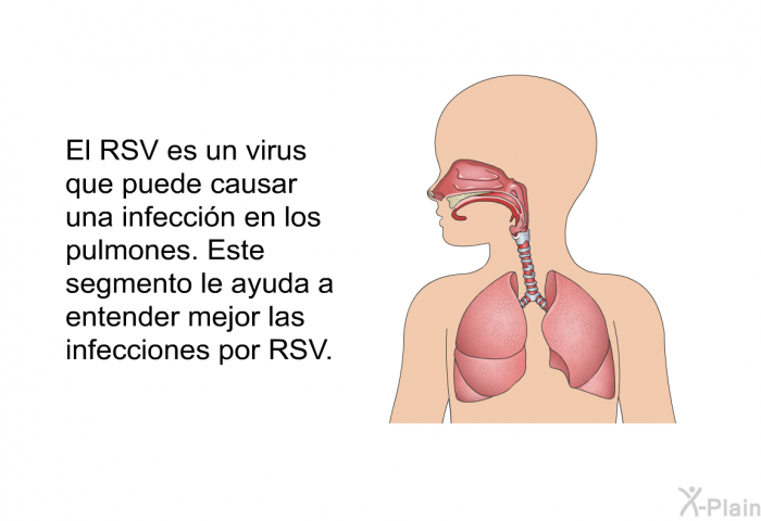 El RSV es un virus que puede causar una infeccin en los pulmones. Este segmento le ayuda a entender mejor las infecciones por RSV.