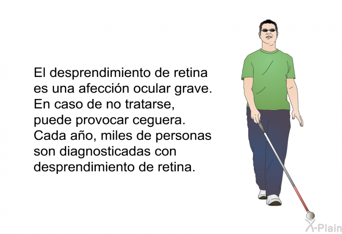 El desprendimiento de retina es una afeccin ocular grave. En caso de no tratarse, puede provocar ceguera. Cada ao, miles de personas son diagnosticadas con desprendimiento de retina.