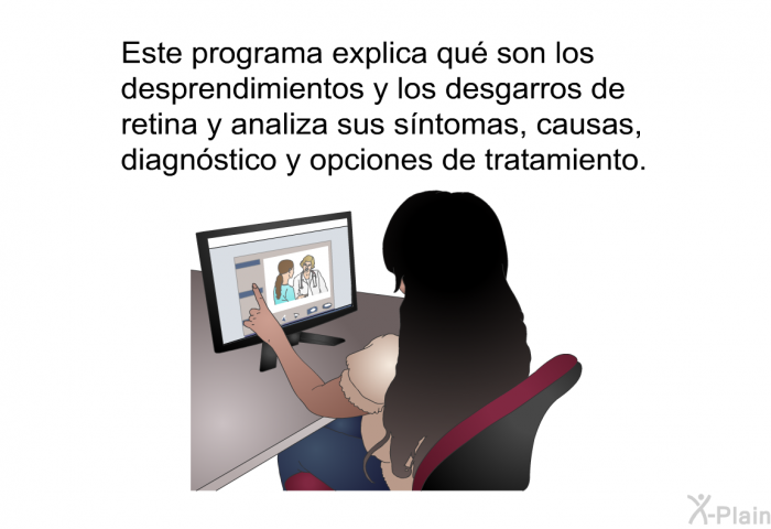 Esta informacin acerca de su salud explica qu son los desprendimientos y los desgarros de retina y analiza sus sntomas, causas, diagnstico y opciones de tratamiento.