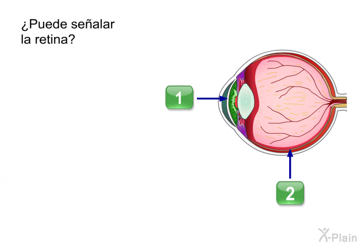 ¿Puede sealar la retina?