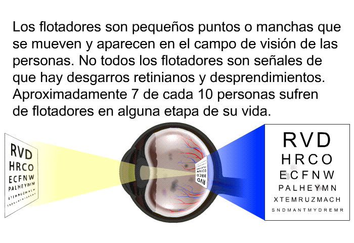 Los flotadores son pequeos puntos o manchas que se mueven y aparecen en el campo de visin de las personas. No todos los flotadores son seales de que hay desgarros retinianos y desprendimientos. Aproximadamente 7 de cada 10 personas sufren de flotadores en alguna etapa de su vida.