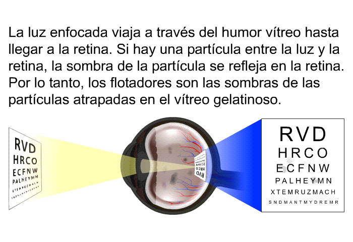 La luz enfocada viaja a travs del humor vtreo hasta llegar a la retina. Si hay una partcula entre la luz y la retina, la sombra de la partcula se refleja en la retina. Por lo tanto, los flotadores son las sombras de las partculas atrapadas en el vtreo gelatinoso.
