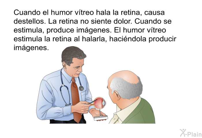 Cuando el humor vtreo hala la retina, causa destellos. La retina no siente dolor. Cuando se estimula, produce imgenes. El humor vtreo estimula la retina al halarla, hacindola producir imgenes.