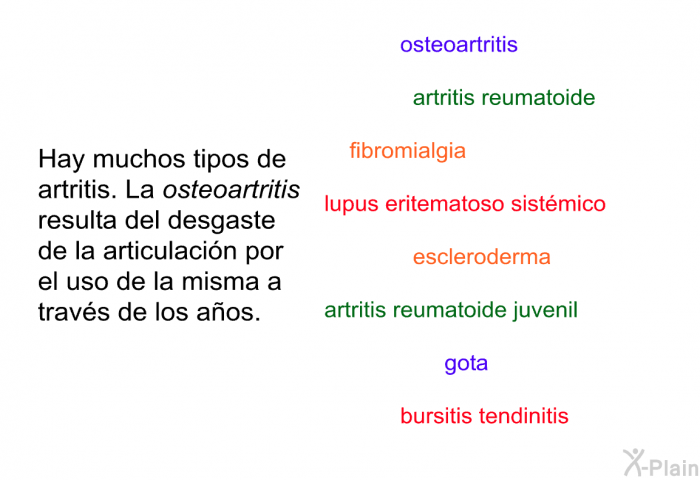 Hay muchos tipos de artritis. La <I>osteoartritis</I> resulta del desgaste de la articulacin por el uso de la misma a travs de los aos.