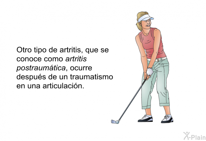 Otro tipo de artritis, que se conoce como <I>artritis postraumtica</I>, ocurre despus de un traumatismo en una articulacin.