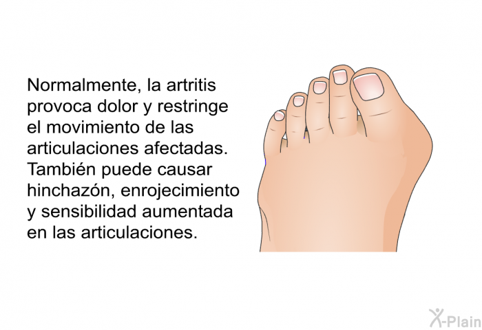 Normalmente, la artritis provoca dolor y restringe el movimiento de las articulaciones afectadas. Tambin puede causar hinchazn, enrojecimiento, y sensibilidad aumentada en las articulaciones.