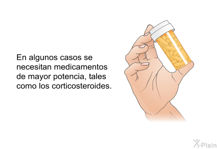 En algunos casos se necesitan medicamentos de mayor potencia, tales como los corticosteroides.