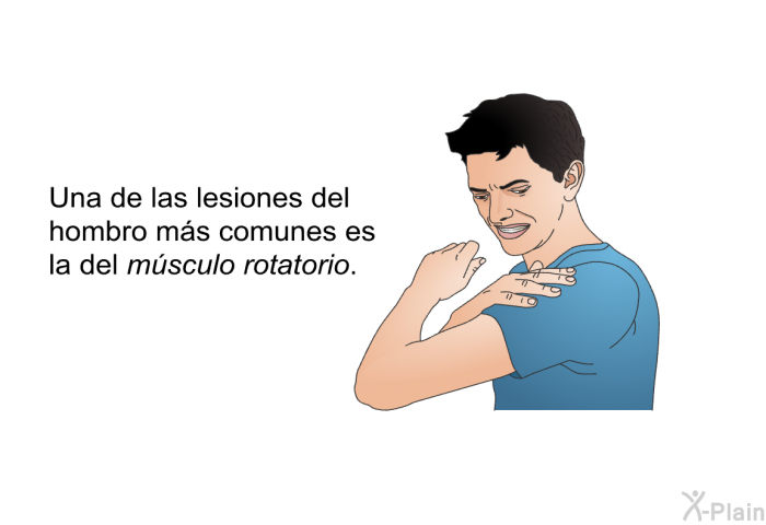 Una de las lesiones del hombro ms comunes es la del<I> msculo rotatorio</I>.