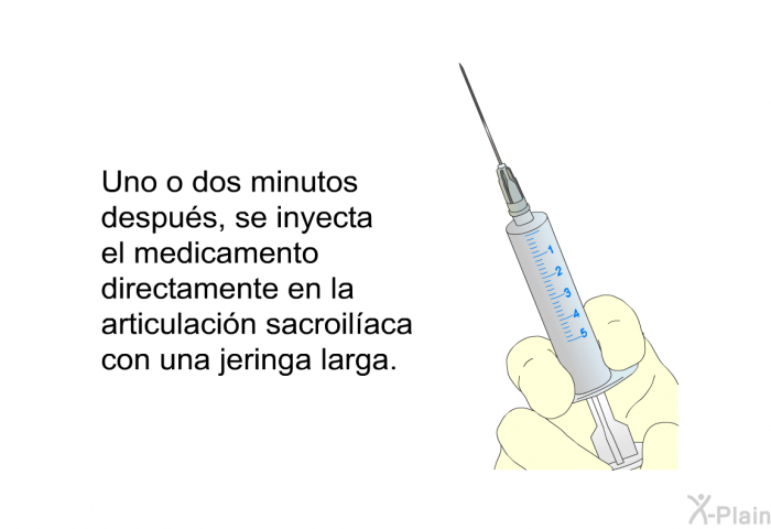 Uno o dos minutos despus, se inyecta el medicamento directamente en la articulacin sacroilaca con una jeringa larga.