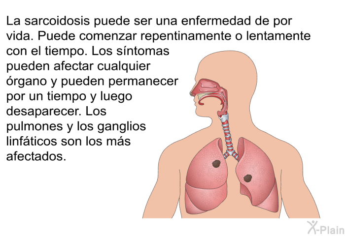 La sarcoidosis puede ser una enfermedad de por vida. Puede comenzar repentinamente o lentamente con el tiempo. Los sntomas pueden afectar cualquier rgano y pueden permanecer por un tiempo y luego desaparecer. Los pulmones y los ganglios linfticos son los ms afectados.