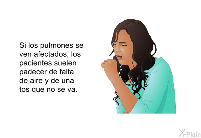 Si los pulmones se ven afectados, los pacientes suelen padecer de falta de aire y de una tos que no se va.