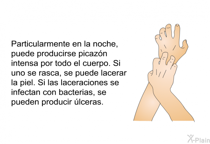 Particularmente en la noche, puede producirse picazn intensa por todo el cuerpo. Si uno se rasca, se puede lacerar la piel. Si las laceraciones se infectan con bacterias, se pueden producir lceras.