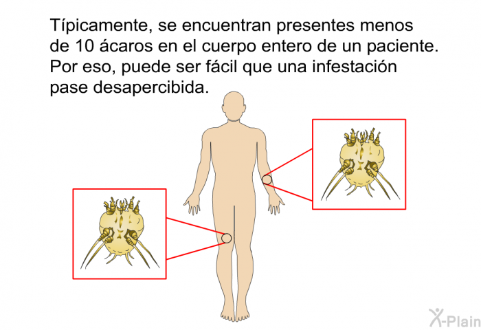 Tpicamente, se encuentran presentes menos de 10 caros en el cuerpo entero de un paciente. Por eso, puede ser fcil que una infestacin pase desapercibida.