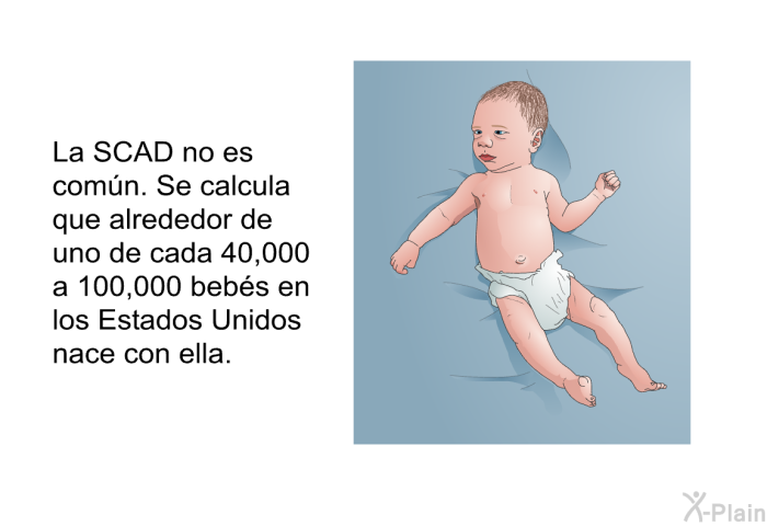 La SCAD no es comn. Se calcula que alrededor de uno de cada 40,000 a 100,000 bebs en los Estados Unidos nace con ella.