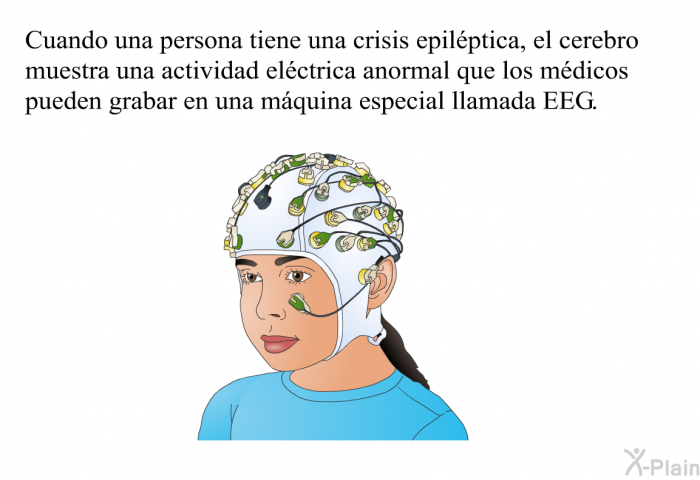 Cuando una persona tiene una crisis epil�ptica, el cerebro muestra una actividad el�ctrica anormal que los m�dicos pueden grabar en una m�quina especial llamada EEG.