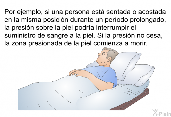 Por ejemplo, si una persona est sentada o acostada en la misma posicin durante un perodo prolongado, la presin sobre la piel podra interrumpir el suministro de sangre a la piel. Si la presin no cesa, la zona presionada de la piel comienza a morir.