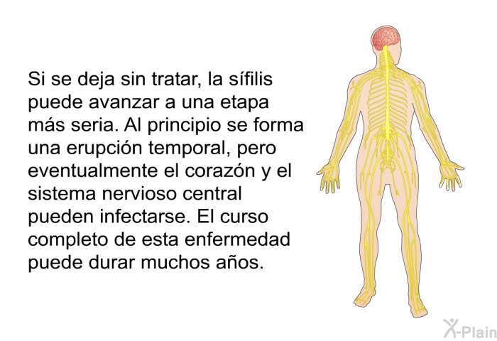 Si se deja sin tratar, la sfilis puede avanzar a una etapa ms seria. Al principio se forma una erupcin temporal, pero eventualmente el corazn y el sistema nervioso central pueden infectarse. El curso completo de esta enfermedad puede durar muchos aos.