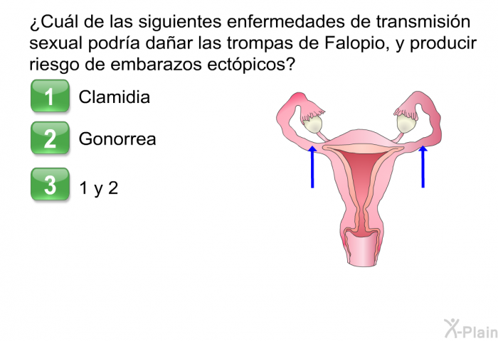 &iquest;Cu�l de las siguientes enfermedades de transmisi�n sexual podr�a da�ar las trompas de Falopio, y producir riesgo de embarazos ect�picos?  Clamidia Gonorrea A y B