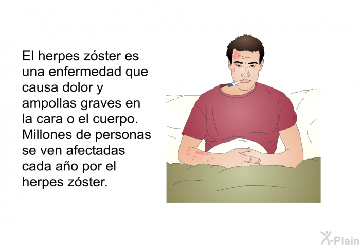 <STRONG>El herpes zster es una enfermedad que causa dolor y ampollas graves en la cara o el cuerpo. <STRONG>Millones de personas se ven afectadas cada ao por el herpes zster.