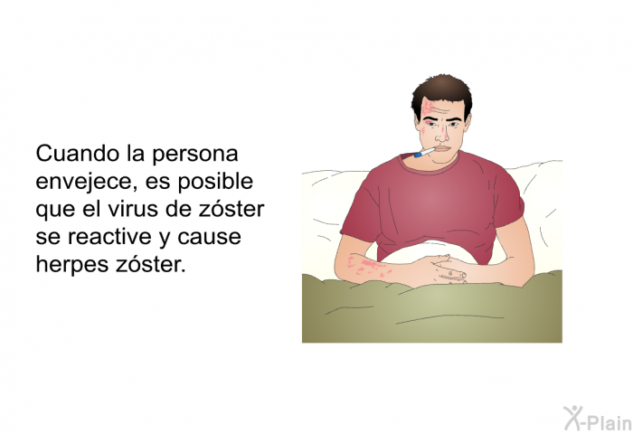Cuando la persona envejece, es posible que el virus de z<STRONG>ster se reactive y cause herpes z<STRONG>ster.