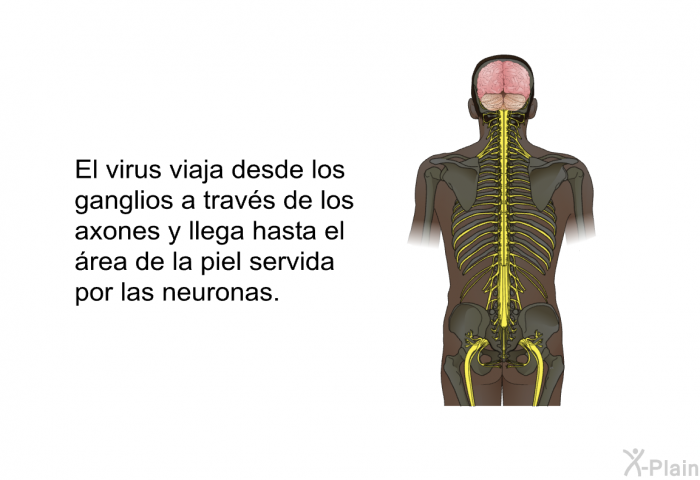 El virus viaja desde los ganglios a travs de los axones y llega hasta el rea de la piel servida por las neuronas.