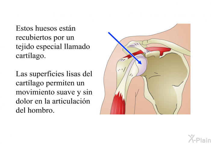 Estos huesos estn recubiertos por un tejido especial llamado <I>cartlago</I>. Las superficies lisas del cartlago permiten un movimiento suave y sin dolor en la articulacin del hombro.