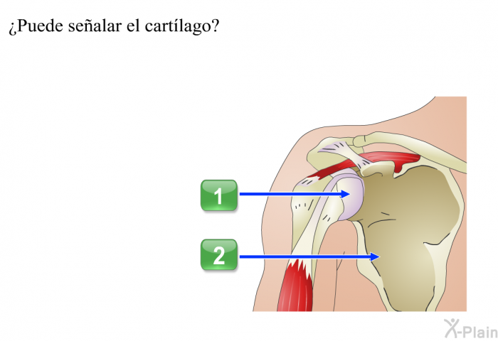 ¿Puede sealar el cartlago?