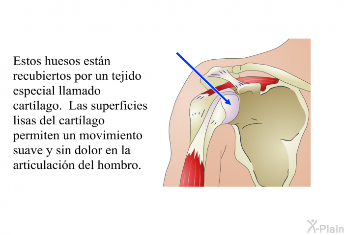 Estos huesos estn recubiertos por un tejido especial llamado <I>cartlago</I>. Las superficies lisas del cartlago permiten un movimiento suave y sin dolor en la articulacin del hombro.