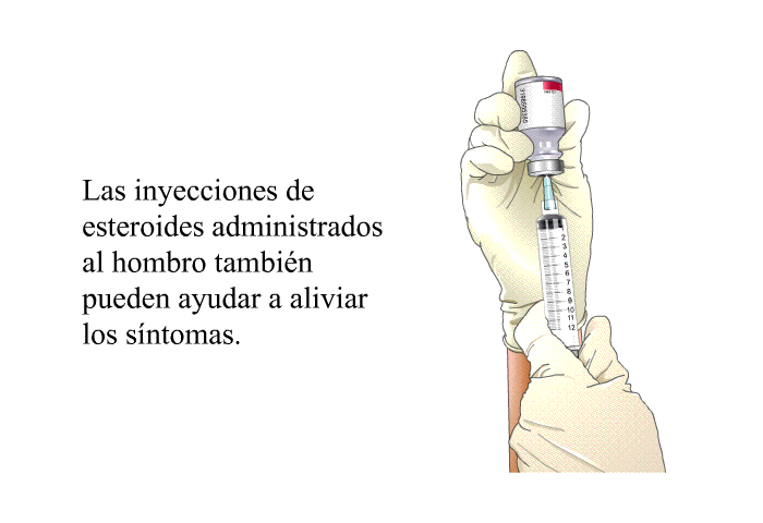 Las inyecciones de esteroides administrados al hombro tambi�n pueden ayudar a aliviar los s�ntomas.