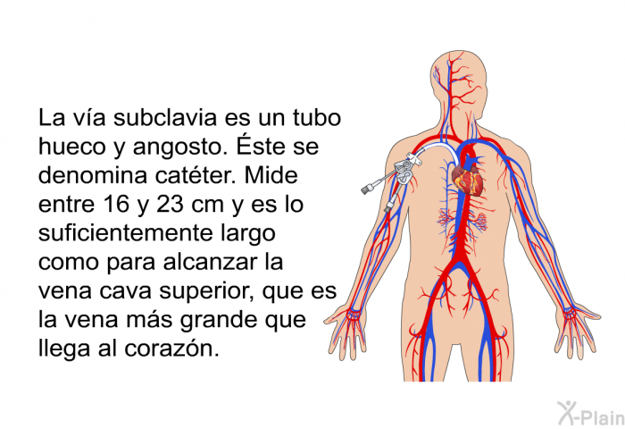 La va subclavia es un tubo hueco y angosto. Éste se denomina catter. Mide entre 16 y 23 cm y es lo suficientemente largo como para alcanzar la vena cava superior, que es la vena ms grande que llega al corazn.