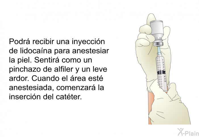 Podr recibir una inyeccin de lidocana para anestesiar la piel. Sentir como un pinchazo de alfiler y un leve ardor. Cuando el rea est anestesiada, comenzar la insercin del catter.