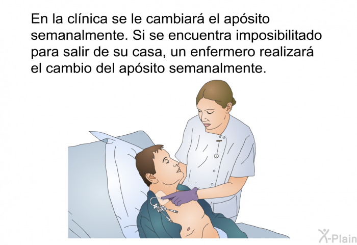 En la clnica se le cambiar el apsito semanalmente. Si se encuentra imposibilitado para salir de su casa, un enfermero realizar el cambio del apsito semanalmente.