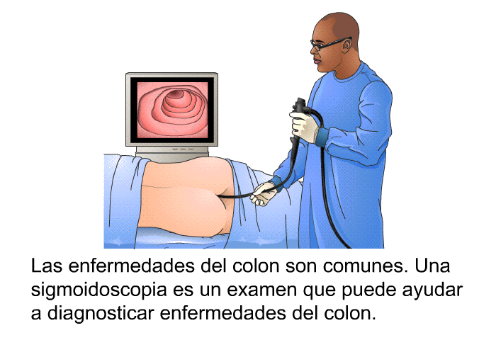 Las enfermedades del colon son comunes. Una sigmoidoscopia es un examen que puede ayudar a diagnosticar enfermedades del colon.
