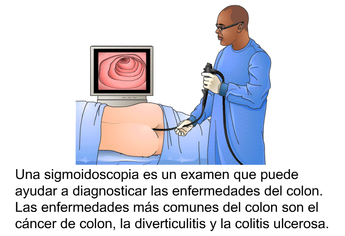 Una sigmoidoscopia es un examen que puede ayudar a diagnosticar las enfermedades del colon. Las enfermedades ms comunes del colon son el cncer de colon, la diverticulitis y la colitis ulcerosa.