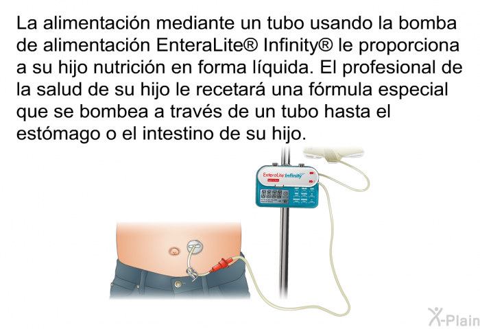 La alimentacin mediante un tubo usando la bomba de alimentacin EnteraLite<SUP> </SUP> Infinity<SUP> </SUP> le proporciona a su hijo nutricin en forma lquida. El profesional de la salud de su hijo le recetar una frmula especial que se bombea a travs de un tubo hasta el estmago o el intestino de su hijo.