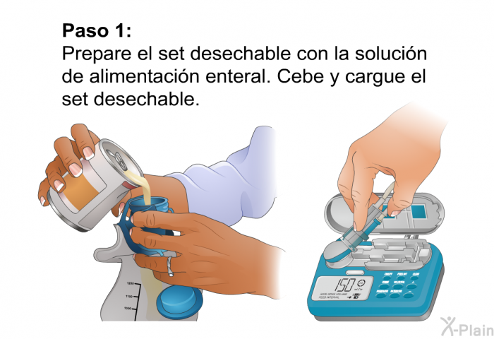 <B>Paso 1:</B> 
 Prepare el set desechable con la solucin de alimentacin enteral. Cebe y cargue el set desechable.