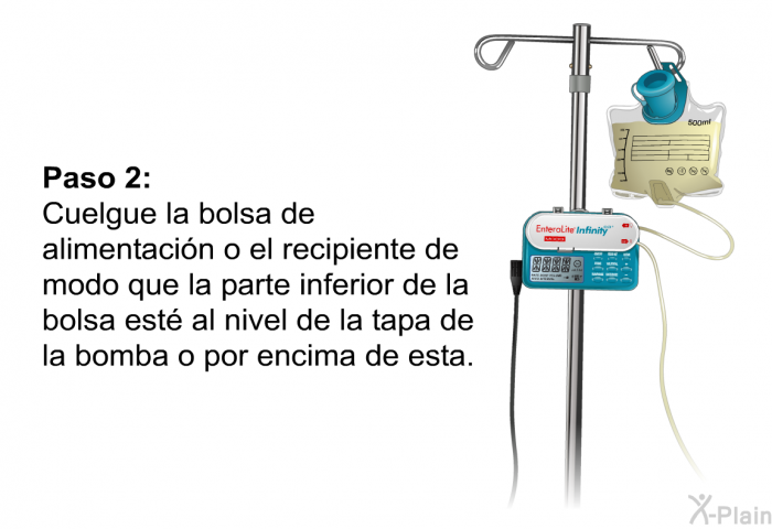 <B>Paso 2:</B> 
 Cuelgue la bolsa de alimentacin o el recipiente de modo que la parte inferior de la bolsa est al nivel de la tapa de la bomba o por encima de esta.