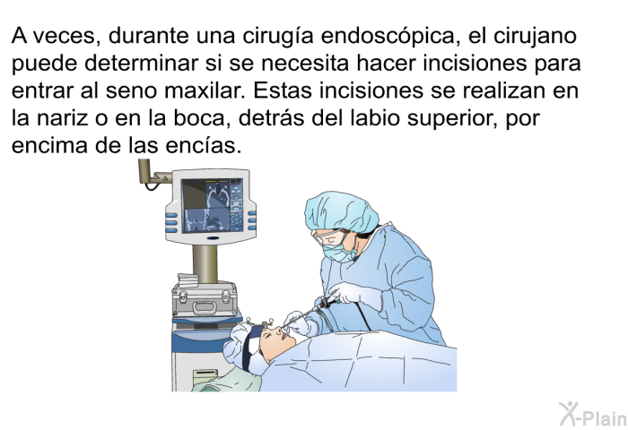 A veces, durante una ciruga endoscpica, el cirujano puede determinar si se necesita hacer incisiones para entrar al seno maxilar. Estas incisiones se realizan en la nariz o en la boca, detrs del labio superior, por encima de las encas.