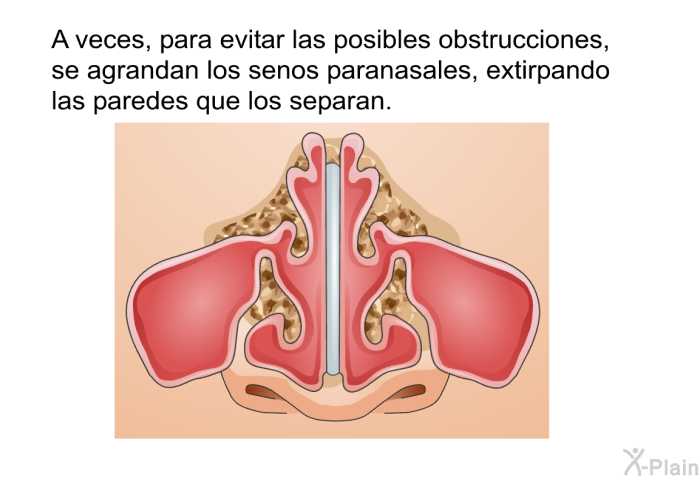A veces, para evitar las posibles obstrucciones, se agrandan los senos paranasales, extirpando las paredes que los separan.