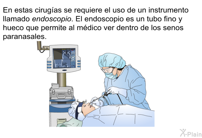 En estas cirugas se requiere el uso de un instrumento llamado endoscopio. El <I>endoscopio</I> es un tubo fino y hueco que permite al mdico ver dentro de los senos paranasales.