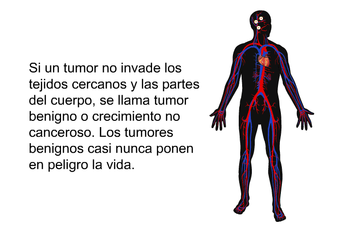 Si un tumor no invade los tejidos cercanos y las partes del cuerpo, se llama <I>tumor benigno</I> o <I>crecimiento no canceroso</I>. Los tumores benignos casi nunca ponen en peligro la vida.