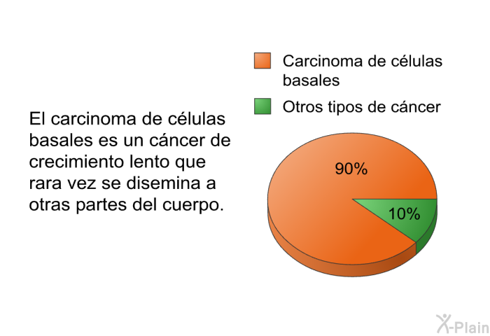 El carcinoma de clulas basales es un cncer de crecimiento lento que rara vez se disemina a otras partes del cuerpo.