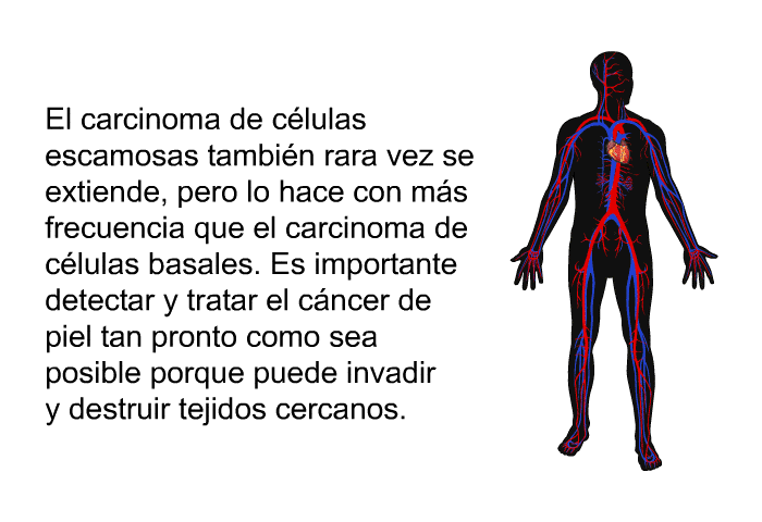 El carcinoma de clulas escamosas tambin rara vez se extiende, pero lo hace con ms frecuencia que el carcinoma de clulas basales. Es importante detectar y tratar el cncer de piel tan pronto como sea posible porque puede invadir y destruir tejidos cercanos.