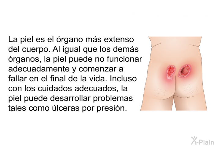 La piel es el rgano ms extenso del cuerpo. Al igual que los dems rganos, la piel puede no funcionar adecuadamente y comenzar a fallar en el final de la vida. Incluso con los cuidados adecuados, la piel puede desarrollar problemas tales como lceras por presin.